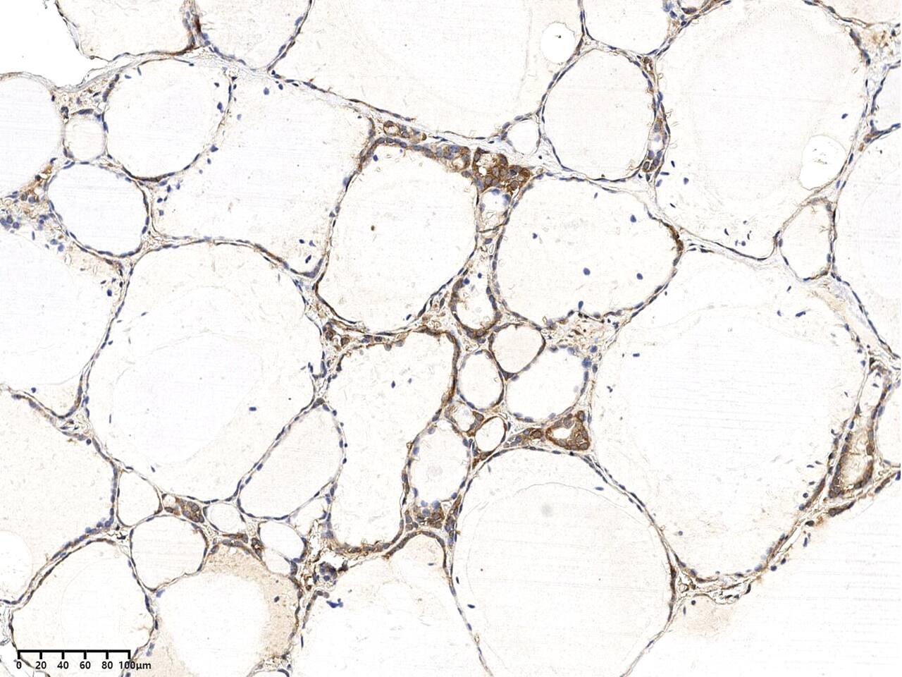 ODR4/TTG1 Antibody - Azide and BSA Free ODR4/TTG1 Antibody - Azide and BSA Free