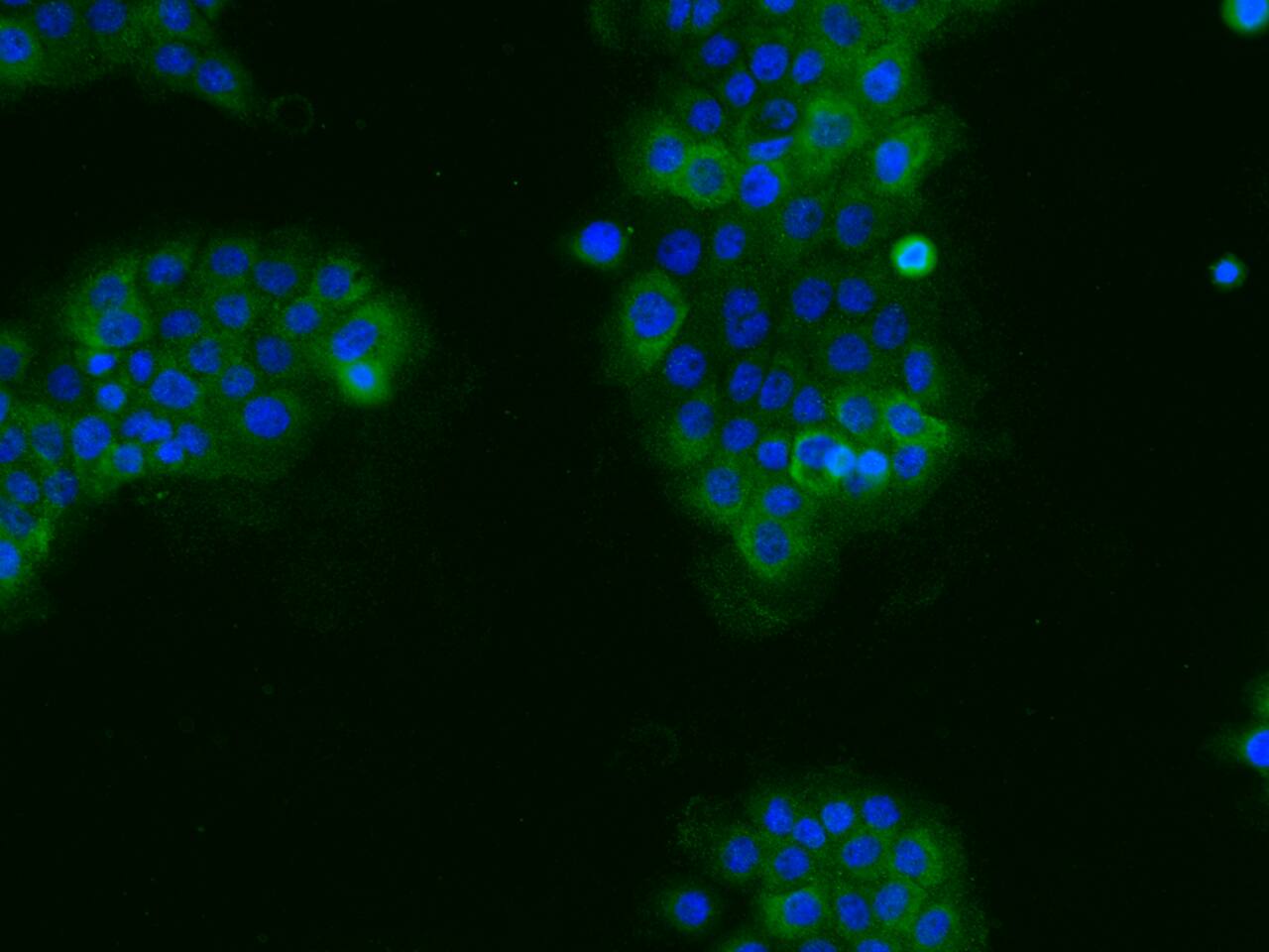 XK X-linked Kx blood group Antibody - Azide and BSA Free XK X-linked Kx blood group Antibody - Azide and BSA Free