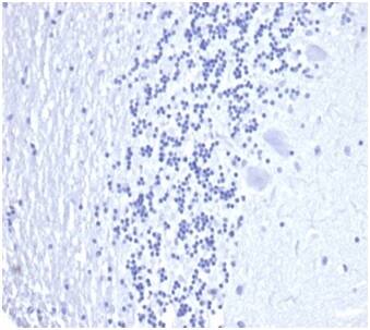 Kallikrein 3/PSA Antibody (KLK3/4602R) - Azide and BSA Free
