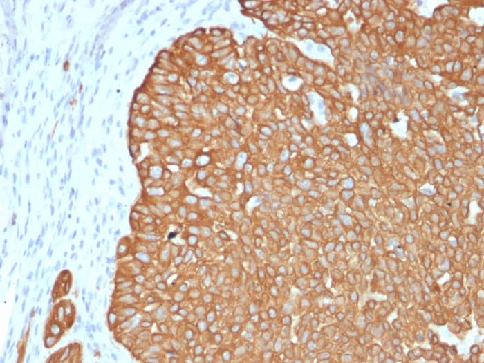 Cytokeratin 5 Antibody (KRT5/4245R) - Azide and BSA Free