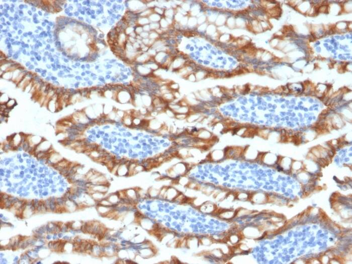 Cytokeratin 8 Antibody (KRT8/2174R) - Azide and BSA Free