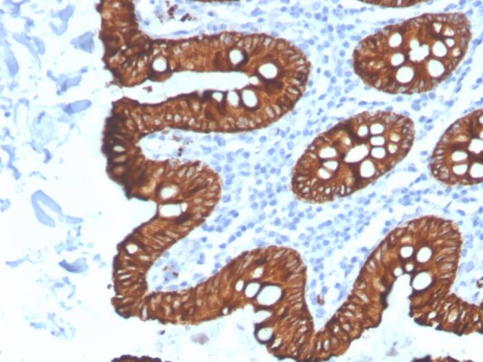 Cytokeratin 8 Antibody (KRT8/4067R) - Azide and BSA Free
