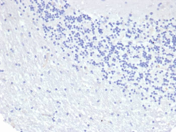 Cytokeratin 8 Antibody (KRT8/6472R) - Azide and BSA Free