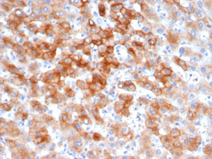 Cytokeratin 8 Antibody (KRT8/6472R) - Azide and BSA Free