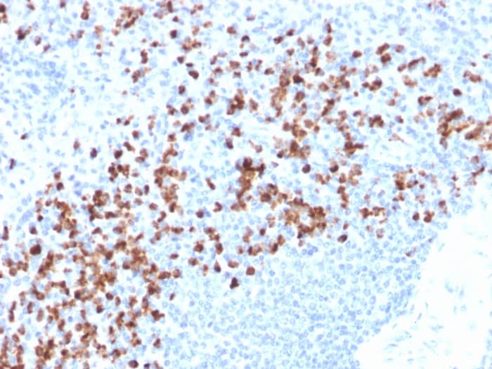 MMP-9 Antibody (rMMP9/1769) - Azide and BSA Free