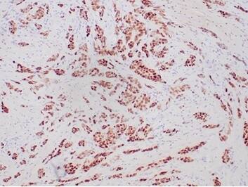 Progesterone R/NR3C3 Antibody (PGR/6854R) - Azide and BSA Free