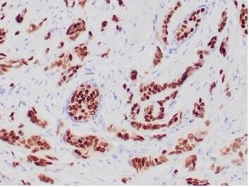 Progesterone R/NR3C3 Antibody (PGR/6854R) - Azide and BSA Free