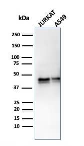 Serpin A1/alpha 1-Antitrypsin Antibody (AAT/3167R) - Azide and BSA Free