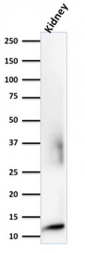beta 2-Microglobulin Antibody (rB2M/961) - Azide and BSA Free