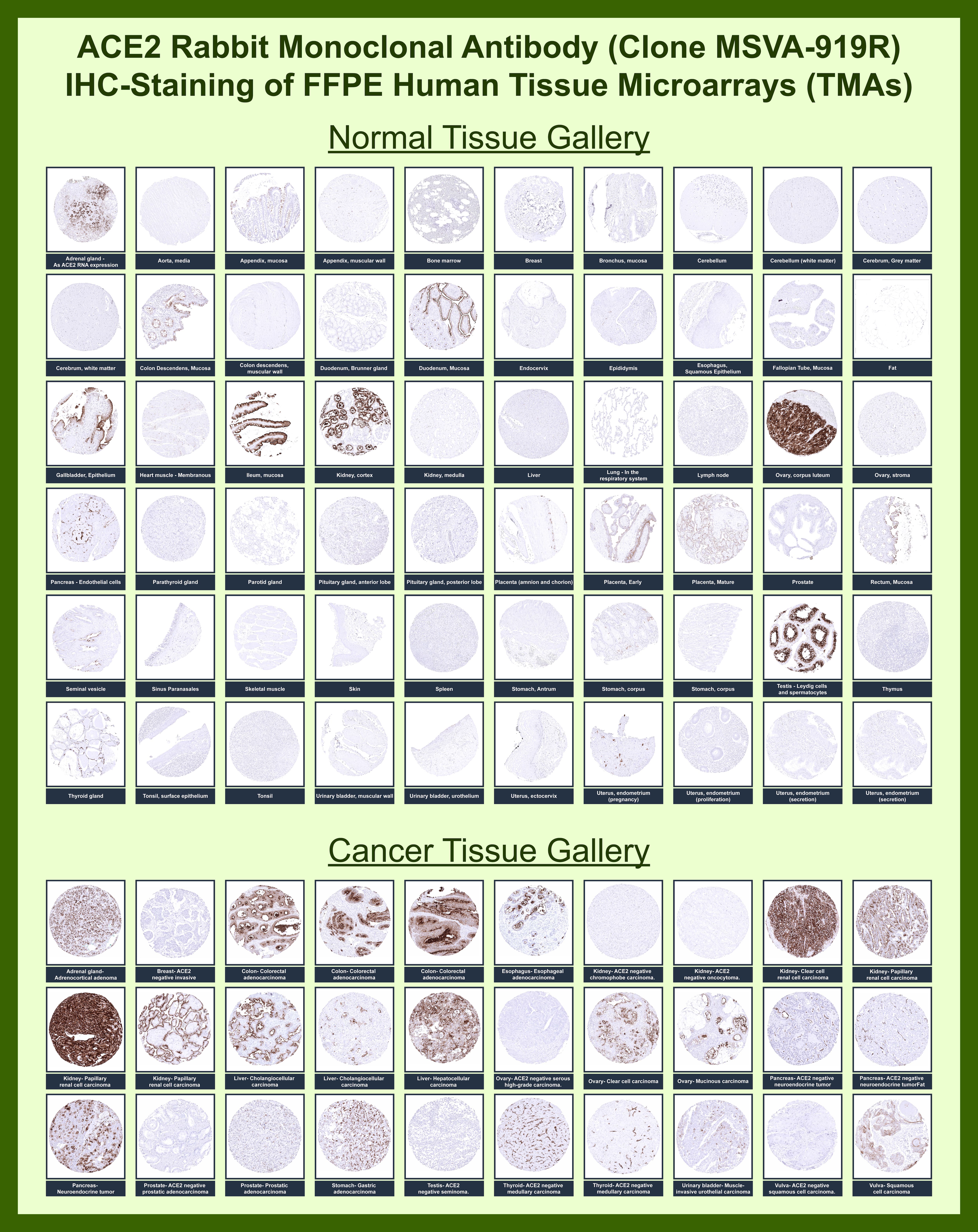 ACE-2 Antibody (ACE2/6788R) - Azide and BSA Free