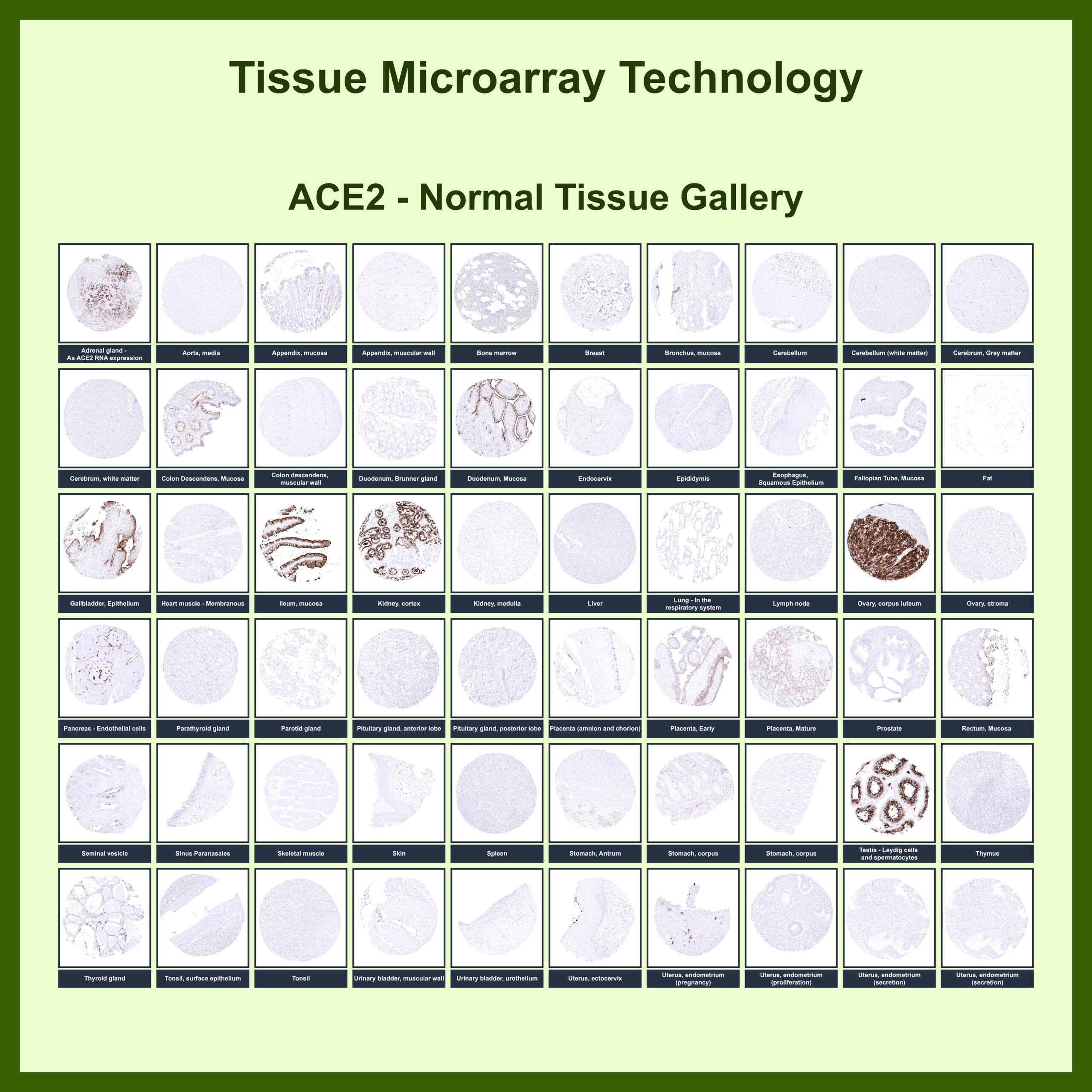 ACE-2 Antibody (ACE2/6788R) - Azide and BSA Free