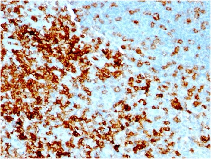 CD43/Sialophorin Antibody (rSPN/1094) - Azide and BSA Free
