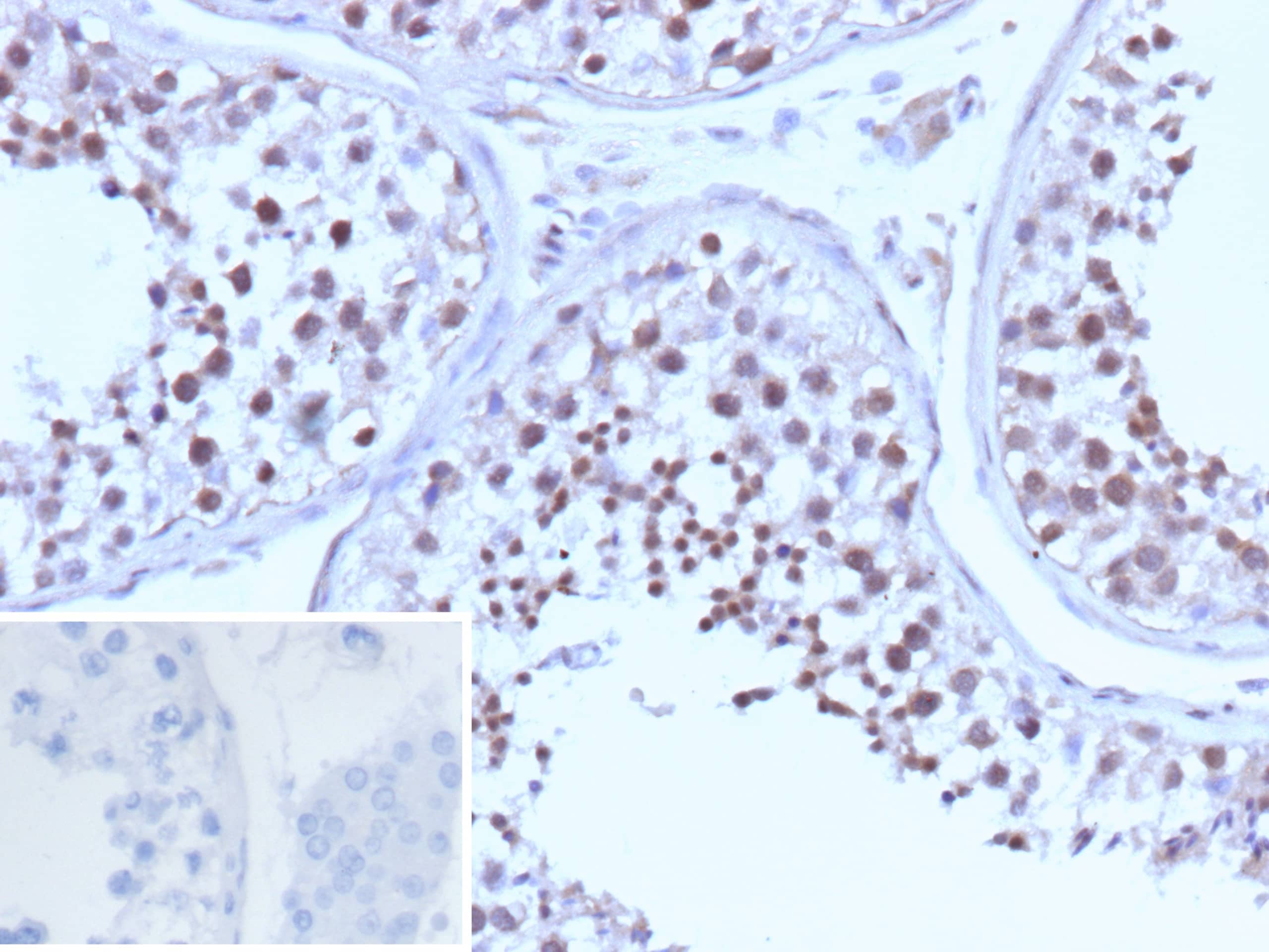 BRCA1 Antibody (BRCA1/13502R) - Azide and BSA Free