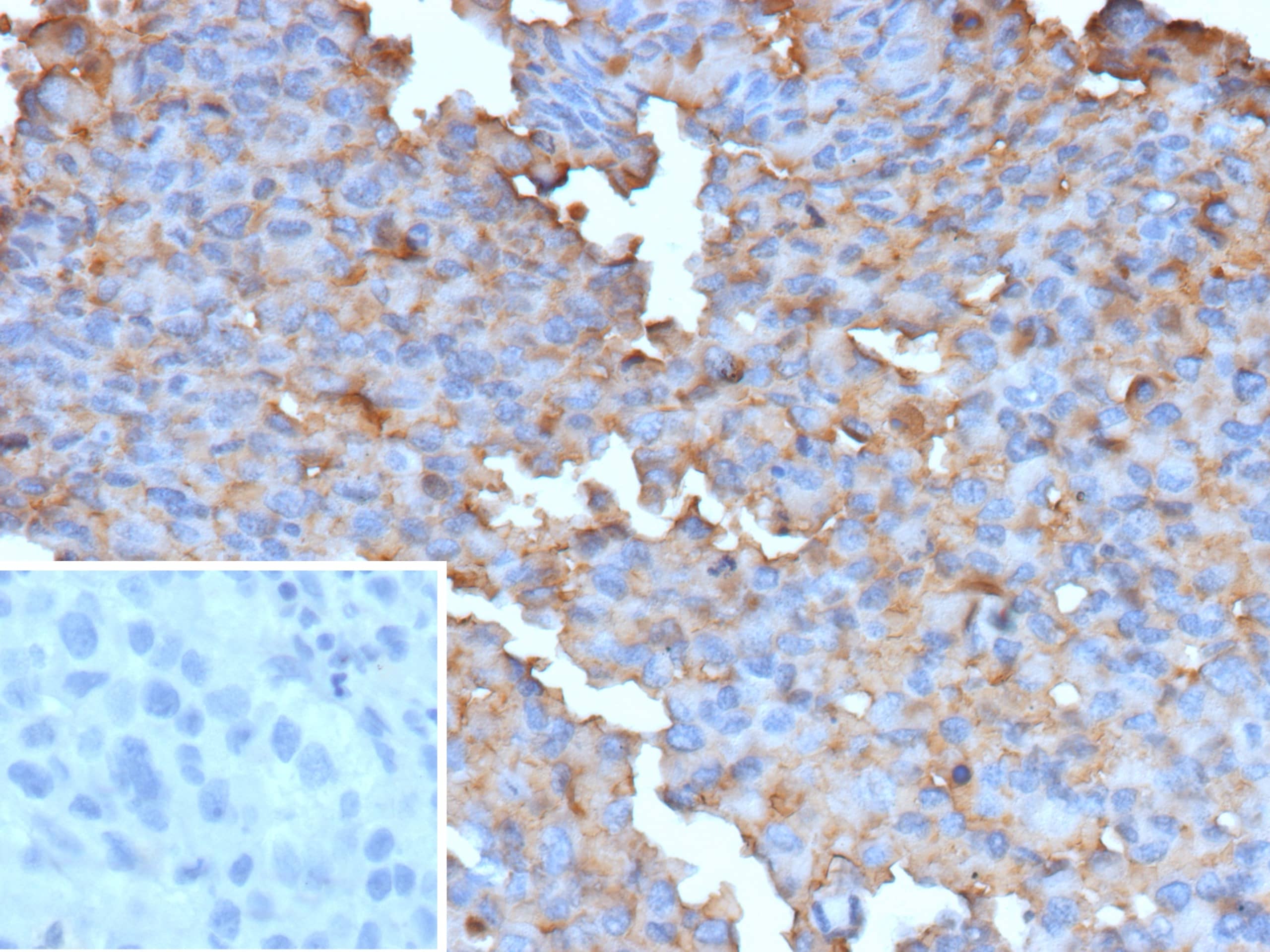B-Raf Antibody (BRAF-V600E/13276R) - Azide and BSA Free