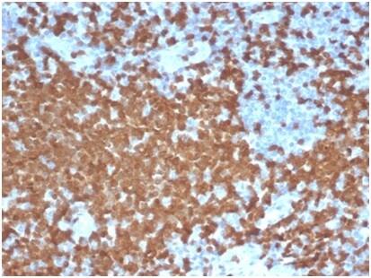 ZAP70 Antibody (ZAP70/6492R) - Azide and BSA Free