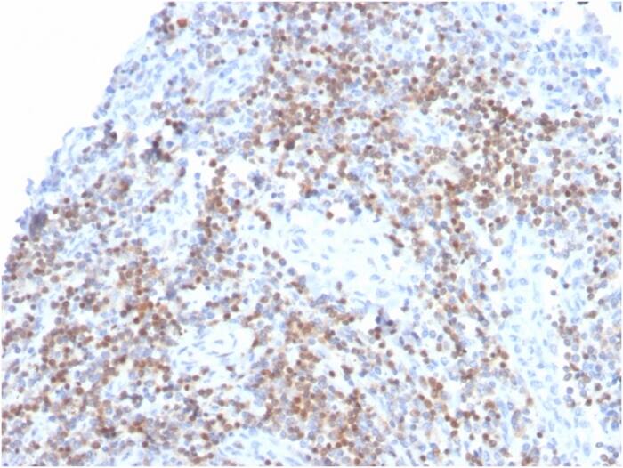 ZAP70 Antibody (ZAP70/3921R) - Azide and BSA Free