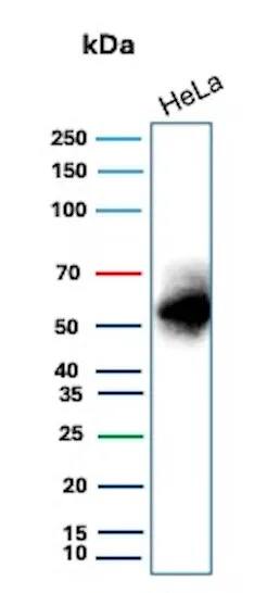 Carbonic Anhydrase IX/CA9 Antibody (CA9/9621R) - Azide and BSA Free
