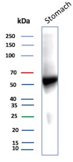 Carbonic Anhydrase IX/CA9 Antibody (CA9/9621R) - Azide and BSA Free