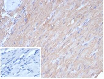 Caldesmon/CALD1 Antibody (rCALD1/7266) - Azide and BSA Free
