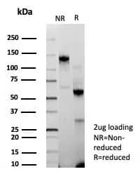 BAP1 Antibody (BAP1/9120R) - Azide and BSA Free