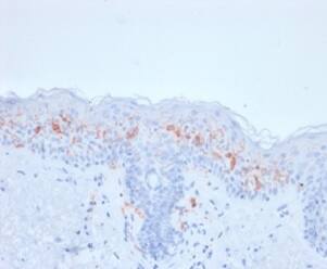 CD1a Antibody (rC1A/711) - Azide and BSA Free