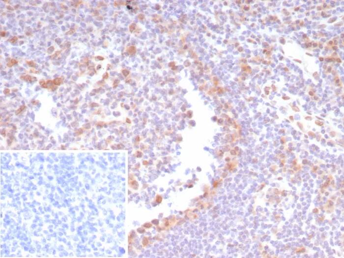 CDK4 Antibody (CDK4/8210R) - Azide and BSA Free