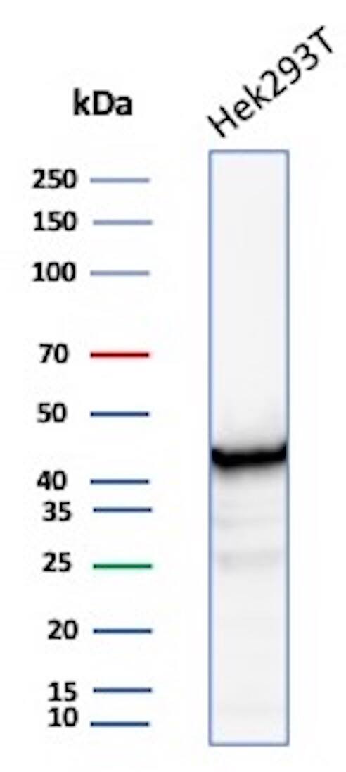 Creatine Kinase BB Antibody (CKBB/8608R) - Azide and BSA Free
