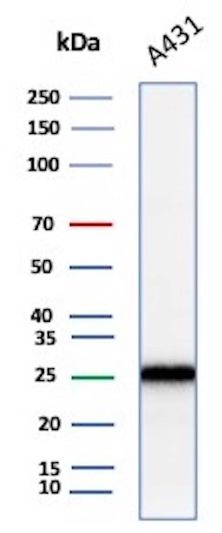 p27/Kip1 Antibody (KIP1/1355R) - Azide and BSA Free