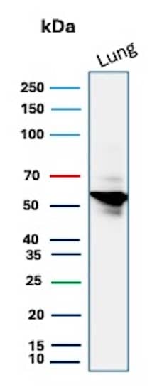 Serpin A1/alpha 1-Antitrypsin Antibody (AAT/3167R) - Azide and BSA Free