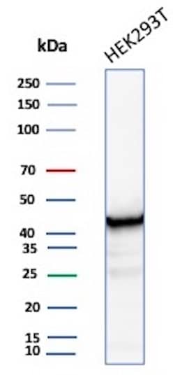 Creatine Kinase BB Antibody (CKBB/8608R) - Azide and BSA Free