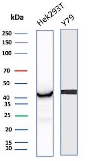 Creatine Kinase BB Antibody (CKBB/8843R) - Azide and BSA Free