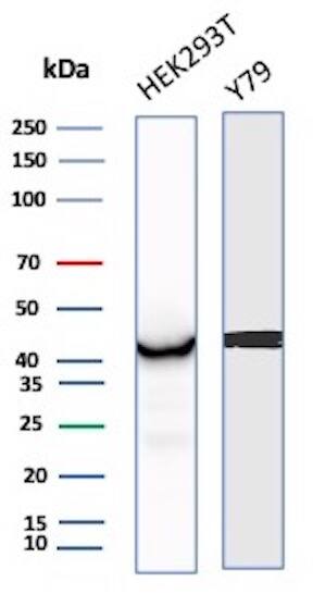 Creatine Kinase BB Antibody (CKBB/8843R) - Azide and BSA Free