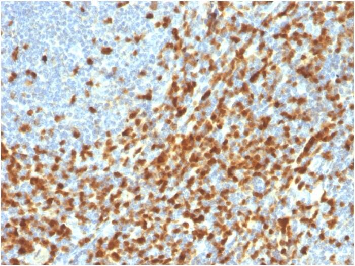 ZAP70 Antibody (ZAP70/3921R) - Azide and BSA Free