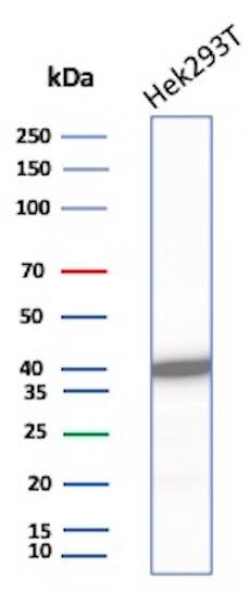 Creatine Kinase BB Antibody (rCKBB/8841) - Azide and BSA Free
