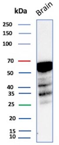 Aldehyde Dehydrogenase 1-A1/ALDH1A1 Antibody (rALDH1A1/7285) - Azide and BSA Free