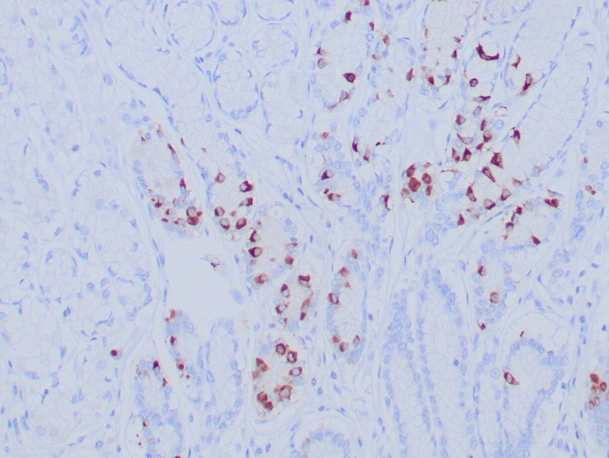 Gastrin Antibody (GAST/8646R) - Azide and BSA Free