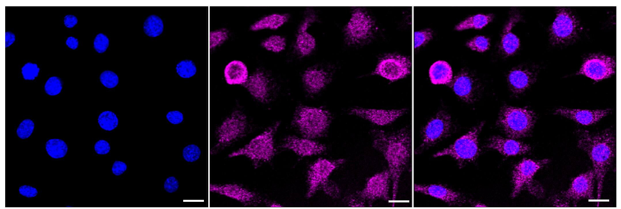 Activin RIIB Antibody (23GB620)