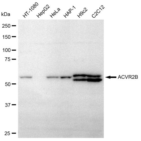 Activin RIIB Antibody (23GB620)