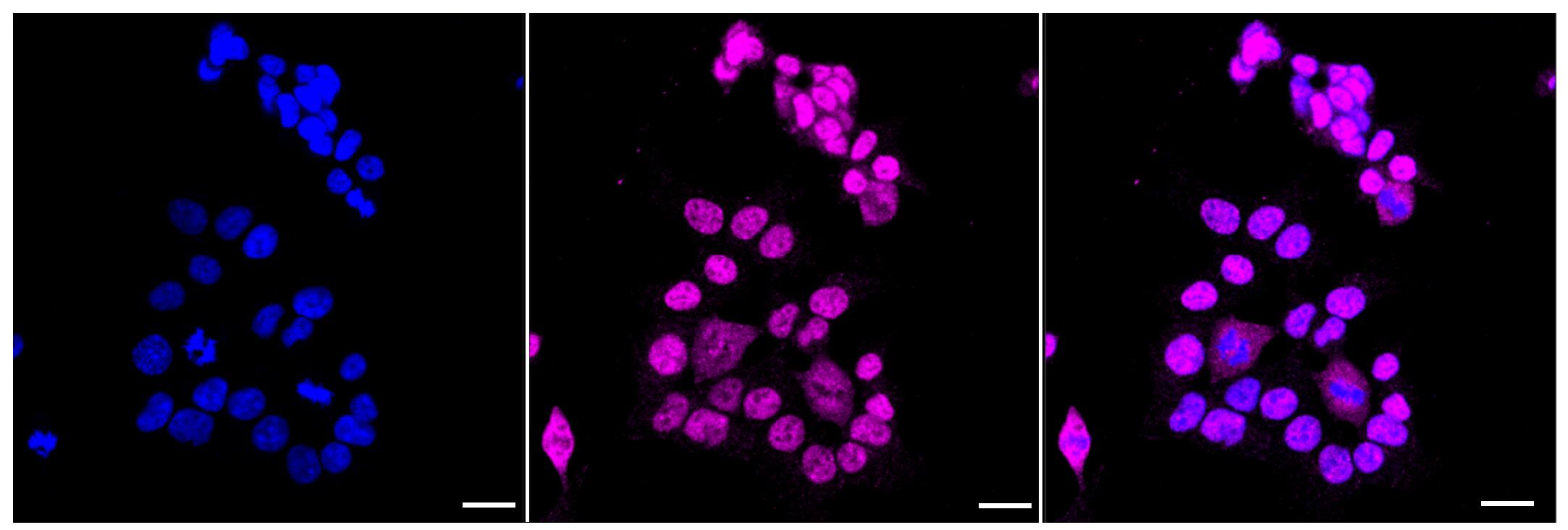Histone Deacetylase 2/HDAC2 Antibody (23GB2655)