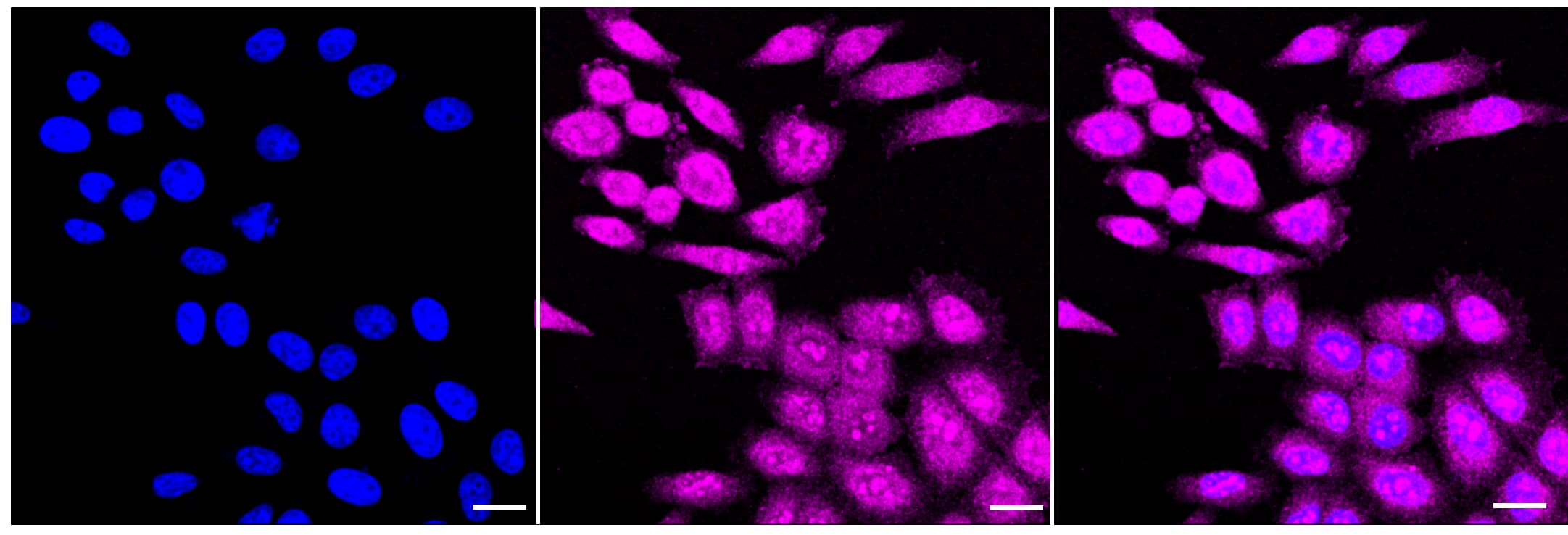 TBK1 [p Ser172] Antibody (23GB2725)