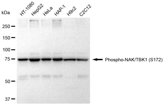 TBK1 [p Ser172] Antibody (23GB2725)
