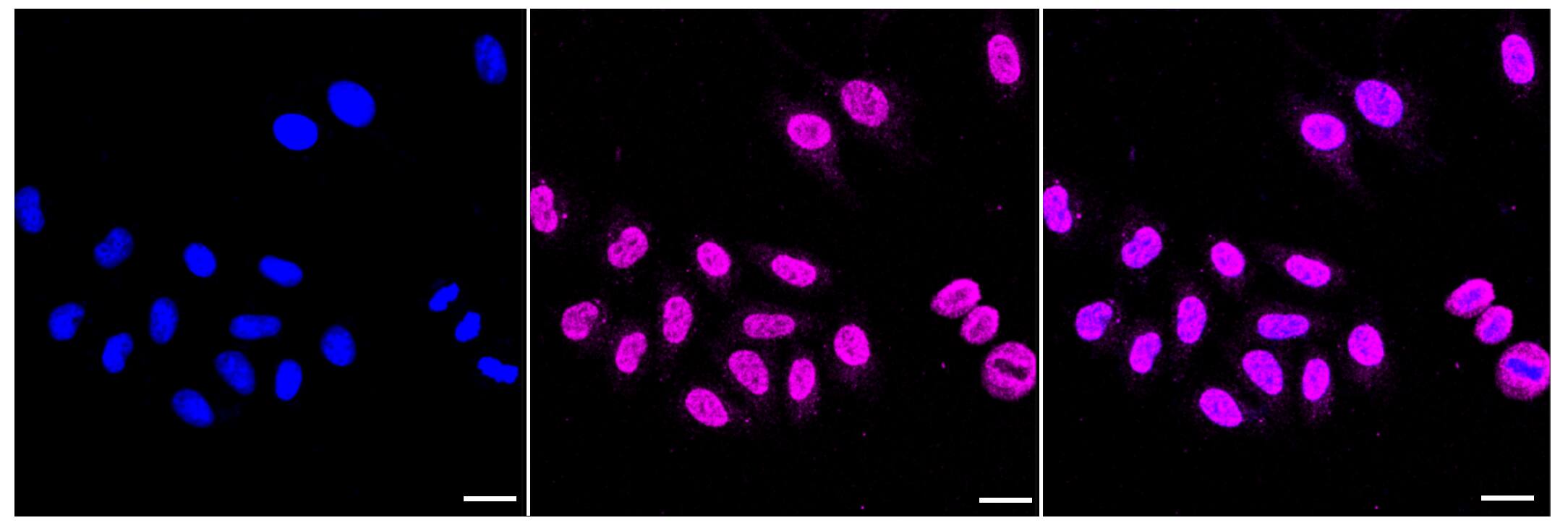 Alpha Actinin 3 Antibody (23GB3625)