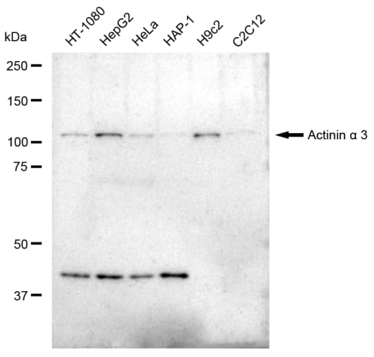 Alpha Actinin 3 Antibody (23GB3625)