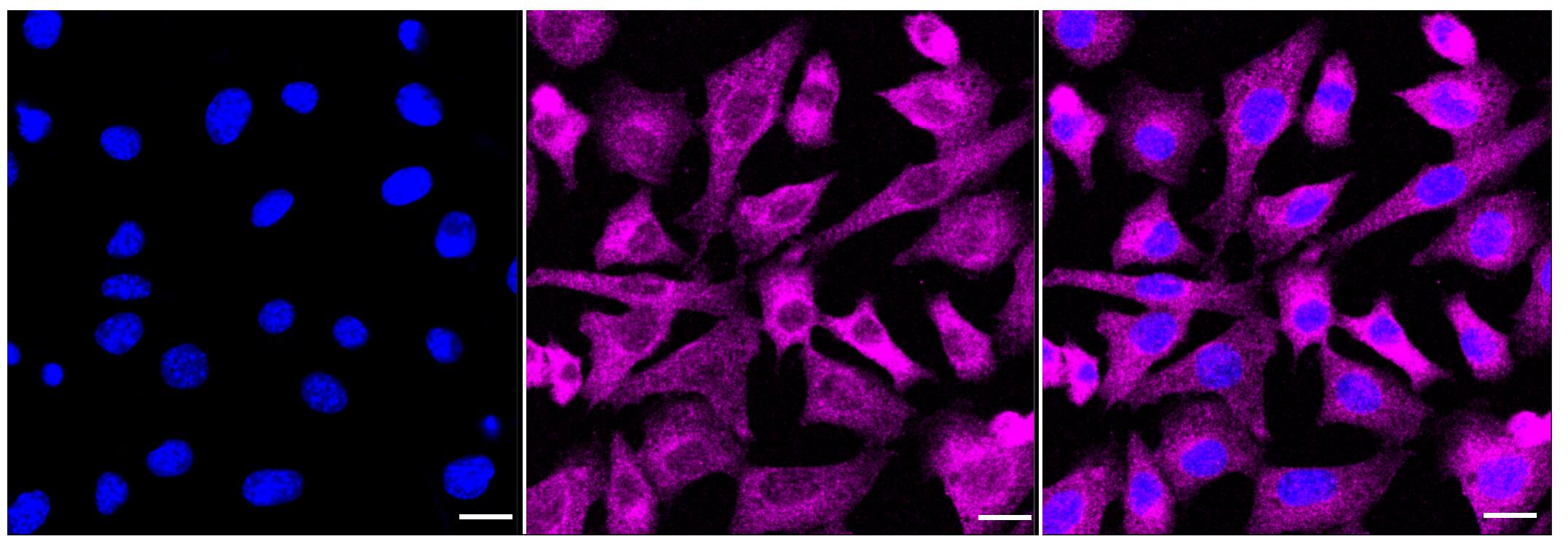 Acetyl-CoA Carboxylase alpha/ACACA [p Ser79] Antibody (23GB3865)