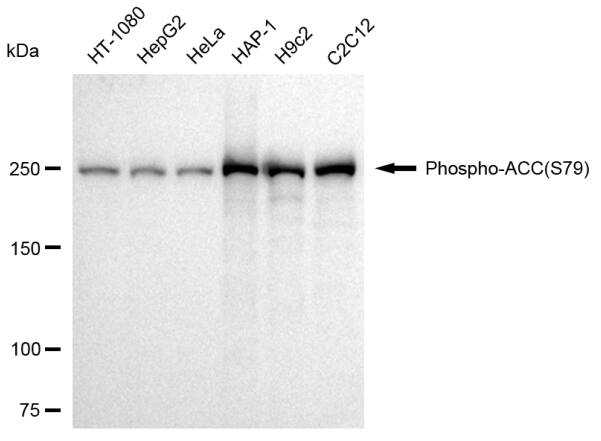 Acetyl-CoA Carboxylase alpha/ACACA [p Ser79] Antibody (23GB3865)