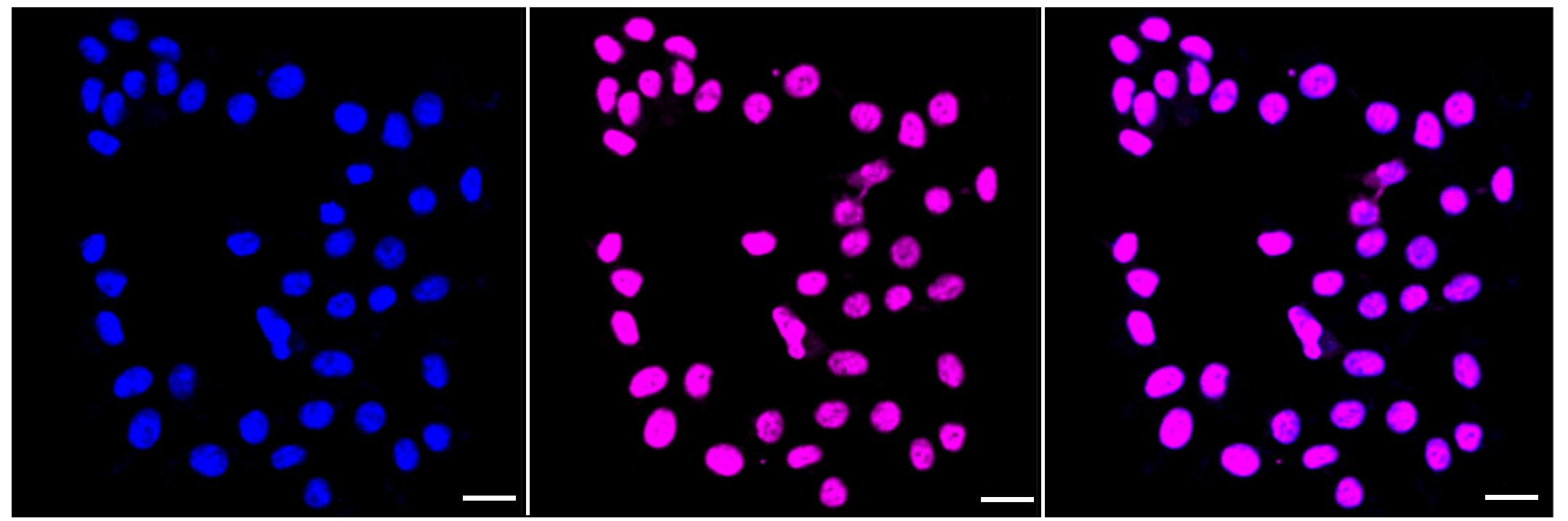 Smad5 [p Ser465] Antibody (23GB4075)