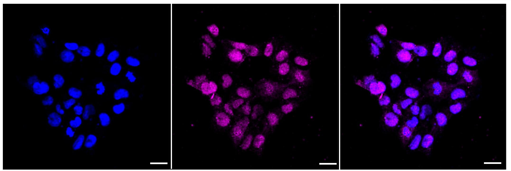 SMAD1/5/9 [p Ser467] Antibody (23GB4155)