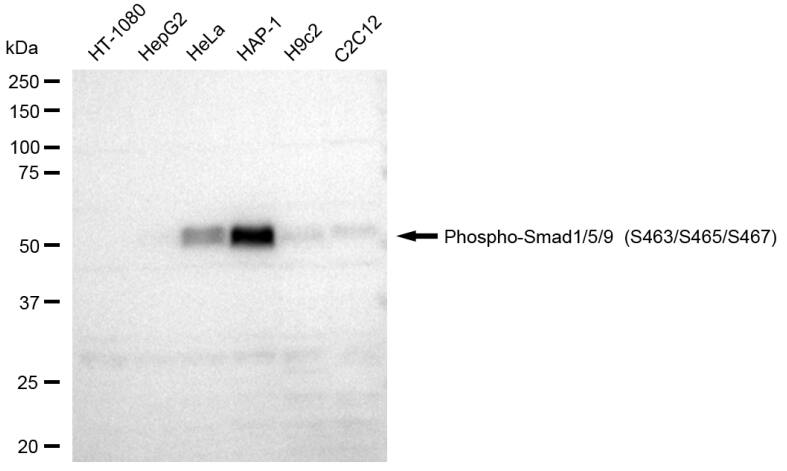 SMAD1/5/9 [p Ser467] Antibody (23GB4155)