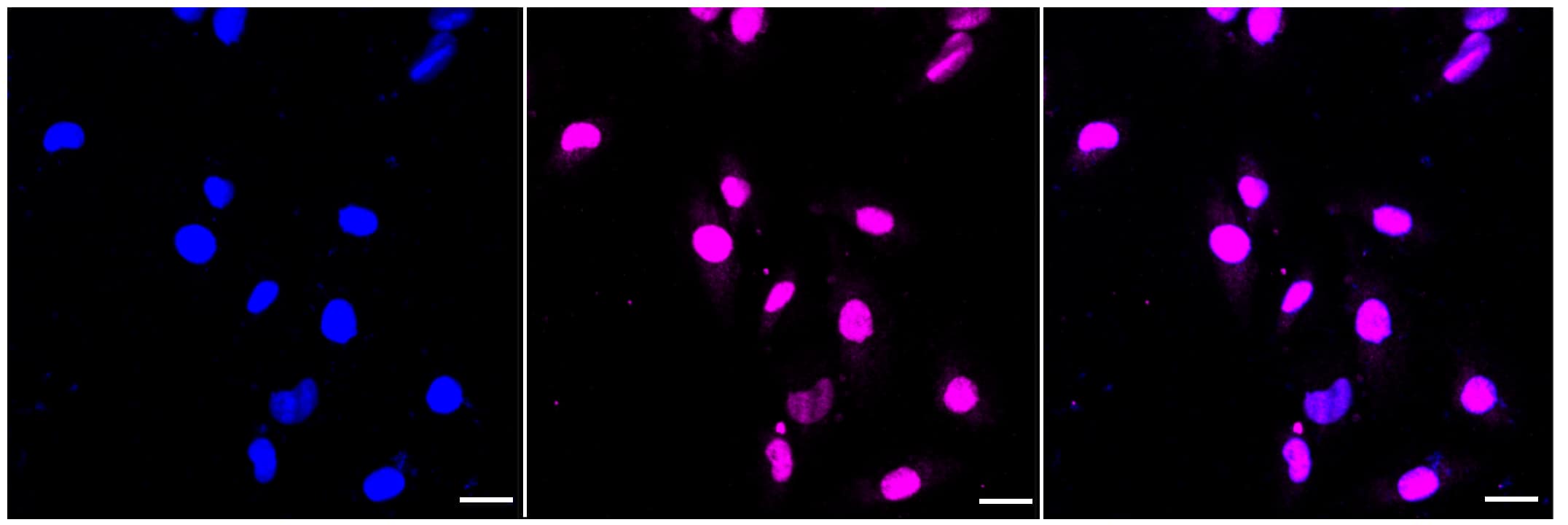 STAT1 [p Tyr701] Antibody (23GB4200)