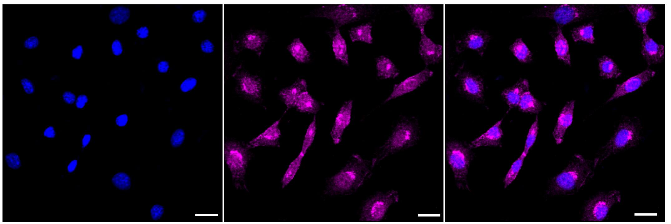 alcohol dehydrogenase 1A Antibody (23GB4295)